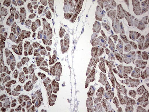 ANO1 / DOG1 / TMEM16A Antibody (aa1-333, clone OTI1C8)