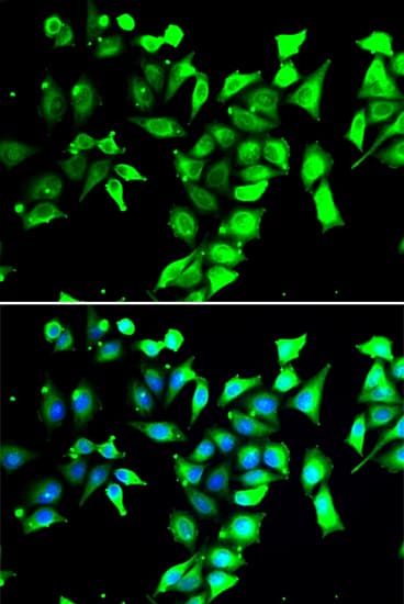 IHC-plus™ FKBP38 / FKBP8 Antibody (aa60-270)