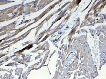 FZD4 / Frizzled 4 Antibody