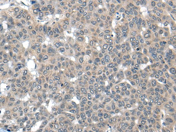CARD16 / COP Antibody