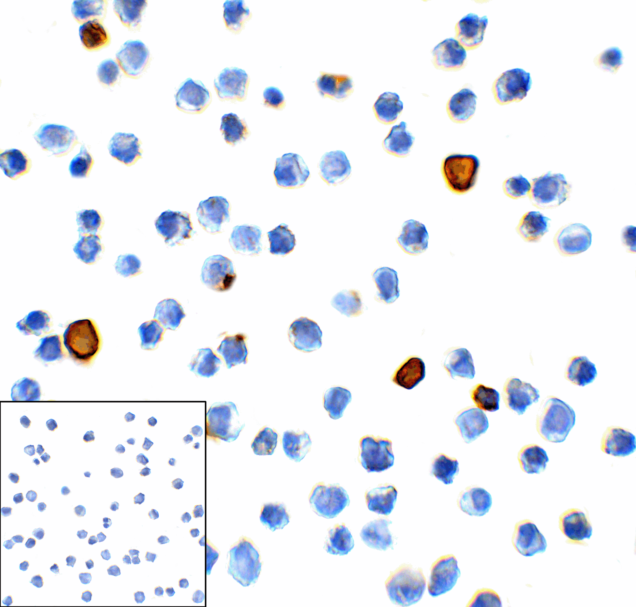 HAVCR2 / TIM-3 Antibody (clone 1H4)