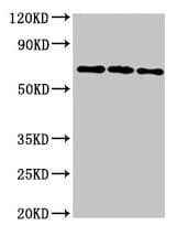 NTN1 / Netrin 1 Antibody