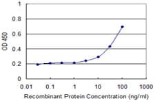 CD1A Antibody (clone M1-2-1B5)