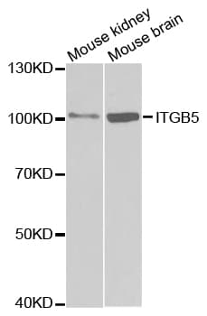 Polyclonal Rabbit anti-Human ITGB5 / Integrin Beta 5 Antibody (IHC, WB)