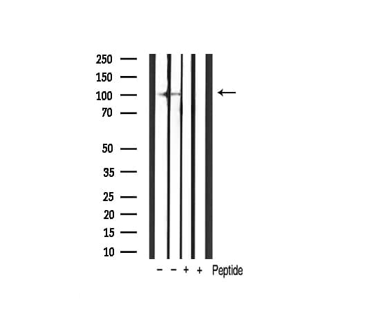 Polyclonal Rabbit anti-Human HIF1A / HIF1 Alpha Antibody (IHC, IF, WB)