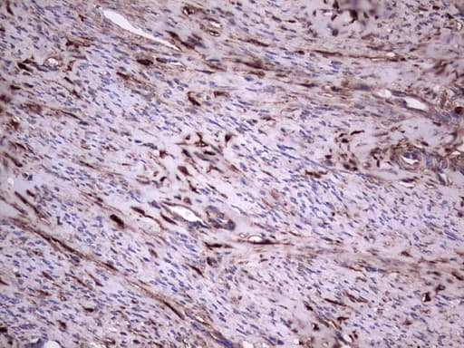 LGALS3 / Galectin 3 Antibody (clone OTI7G9)