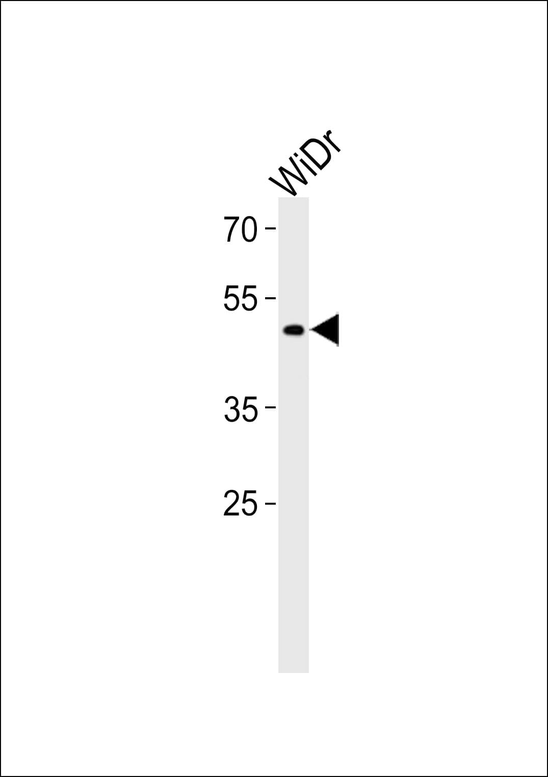 TFDP3 Antibody (aa82-108)