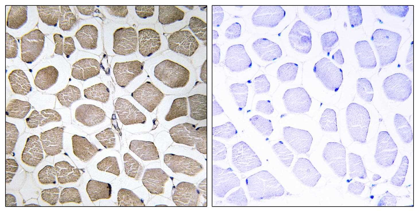 SLC16A12 / MCT12 Antibody