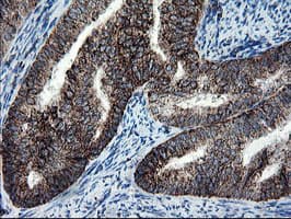SKIL / SNO / SnoN Antibody (clone OTI3F6)