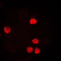PCNA Antibody (Internal)