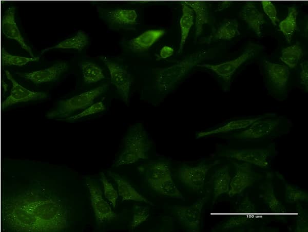 Monoclonal Mouse anti-Human GFRA1 / GFR Alpha Antibody (clone 1G4, IF, WB)