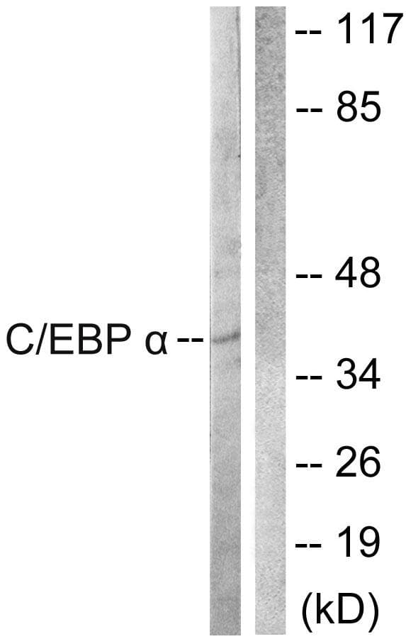 C/EBP Alpha / CEBPA Antibody (p222)