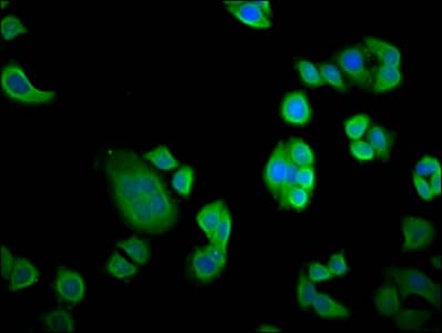 Polyclonal Rabbit anti-Human NEBL LASP2 Antibody (IF)