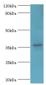 Polyclonal Rabbit anti-Human PDLIM1 Antibody (aa1-329, IHC, WB)