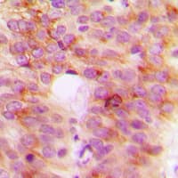 TANK Antibody (Internal)