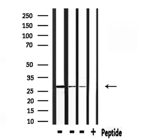 PRDX3 / Peroxiredoxin 3 Antibody