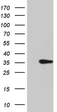 Monoclonal Mouse anti-Human TNFSF10 / TRAIL Antibody (clone OTI6B5, aa39-281, WB)