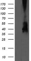 MAP2K3 / MEK3 / MKK3 Antibody (clone OTI1D2, Carrier-free)
