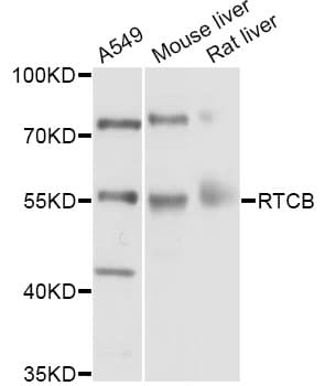 RTCB / C22orf28 Antibody