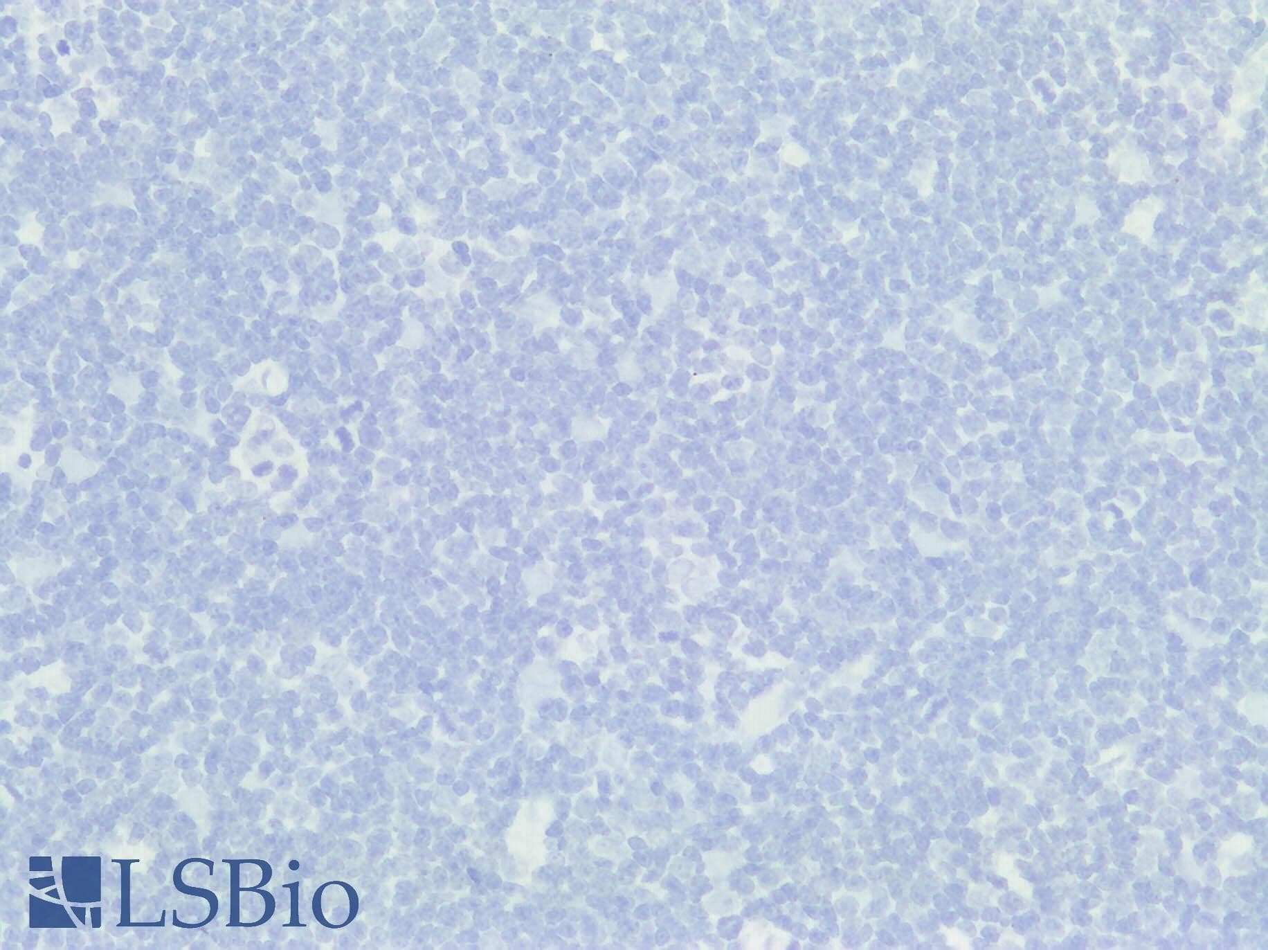 PathPlus™ Polyclonal Rabbit anti-Human BMP6 Antibody (IHC)