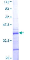 Human COL5A2 / Collagen V Alpha 2 Protein (Recombinant GST, N-terminus)