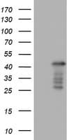 PRX-1 / PRRX1 Antibody (clone OTI1F8)