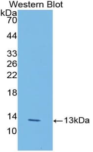 LOXL2 Antibody (aa53-160)