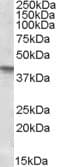 IHC-plus™ SFRP4 Antibody (aa239-253)