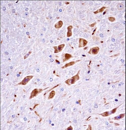 PAK3 Antibody (aa124-152)