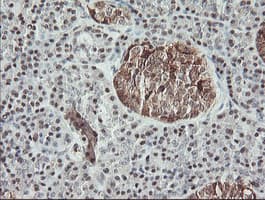 MSI1 / Musashi 1 Antibody (clone OTI2H9, Carrier-free)