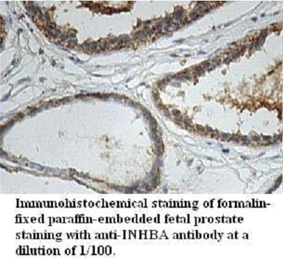 Polyclonal Rabbit anti-Human INHBA / Inhibin Beta A Antibody (aa126-391, IHC, WB)