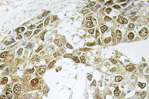 NFKBIA / IKB Alpha / IKBA Antibody (Ser36)