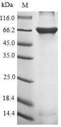 Rabies Virus POLR2G / RPB7 Protein (Recombinant 10His-SUMO, N-terminus + Myc, C-terminus)