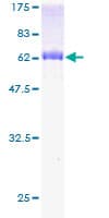 Human WDR45 Protein (Recombinant GST)
