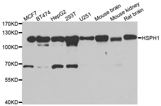 Polyclonal Rabbit anti-Human HSPH1 / HSP105 Antibody (IHC, WB)