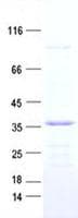 Human CD274 / B7-H1 / PD-L1 Protein (Recombinant DDK,C-terminus)