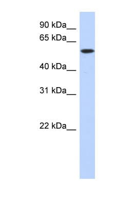 Polyclonal Rabbit anti-Human DNTT / TdT Antibody (C-Terminus, WB)