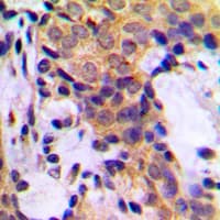 KRT18 / CK18 / Cytokeratin 18 Antibody (N-Terminus)