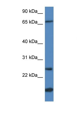 Polyclonal Rabbit anti-Human GSTM5-5 / GSTM5 Antibody (N-Terminus, WB)