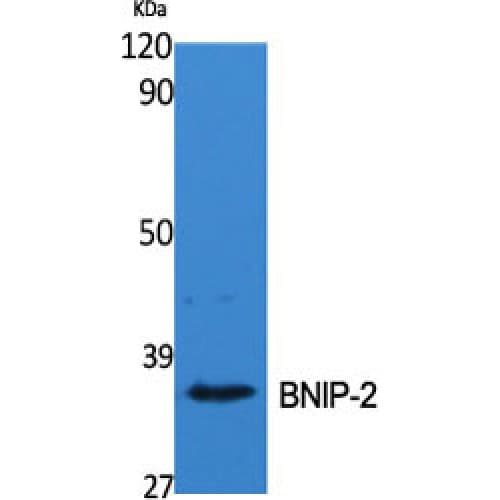 BNIP2 Antibody (Internal)