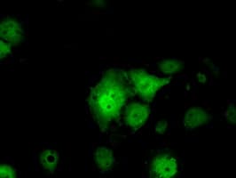 IHC-plus™ SRR / Serine Racemase Antibody (clone 9E8)