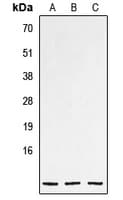 Polyclonal Rabbit anti-Human NPPC Antibody (Internal, WB)