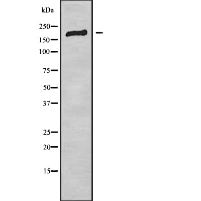 ADGRB2 / BAI2 Antibody