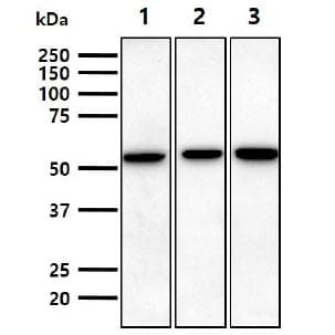 IHC-plus™ NT5E / eNT / CD73 Antibody (aa27-252, clone 2B6)