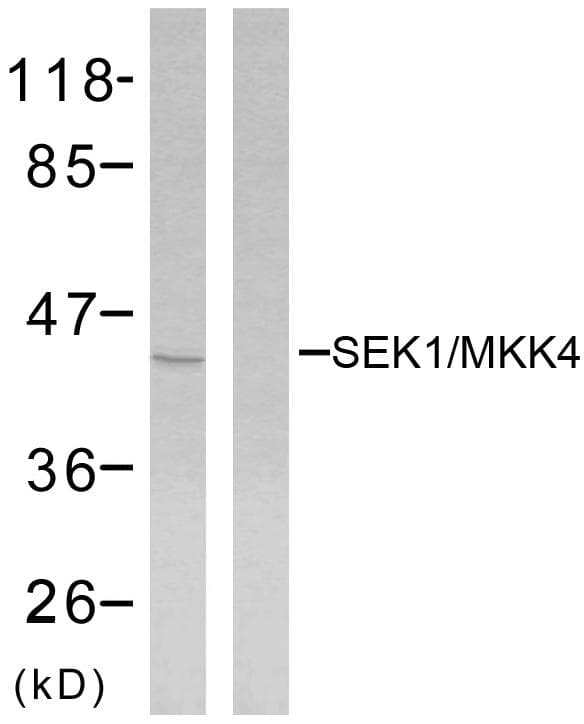 Polyclonal Rabbit anti-Human MAP2K4 / MKK4 Antibody (phospho-Ser80, IHC, WB)
