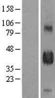 Human DLK1 / Pref-1 Protein (Over-Expression Lysate Myc-DDK (Flag))