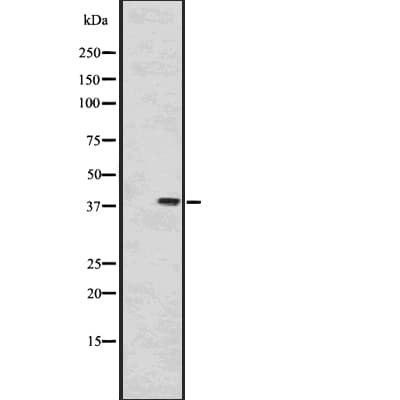 Polyclonal Rabbit anti-Human PPP1CA / PP1-Alpha Antibody (WB)