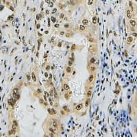 ZNF436 Antibody (Internal)