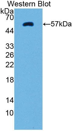 PTK2B / PYK2 Antibody (aa704-941)
