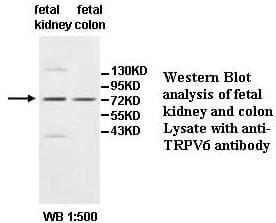 TRPV6 Antibody (C-Terminus)